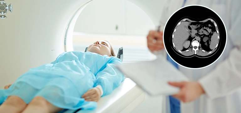 CT Scan Abdomen : Uses, Side Effects, Procedure and Results
